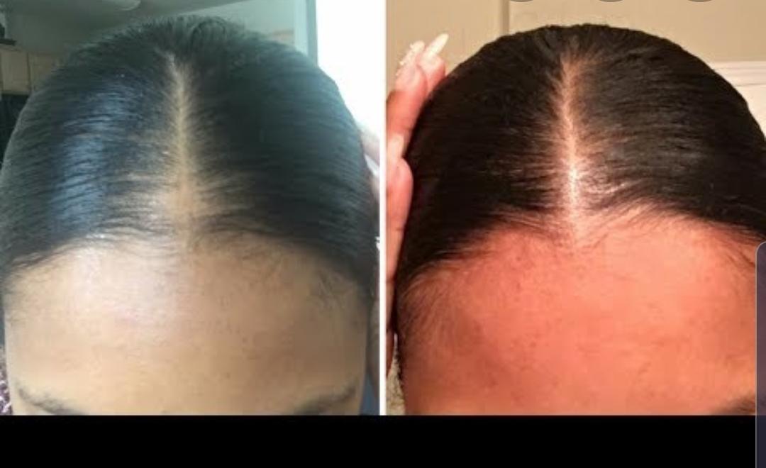 Hair Growth Serum